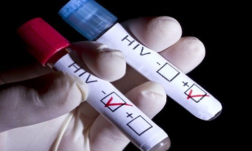 xét nghiệm hiv ở đâu chính xác nhất