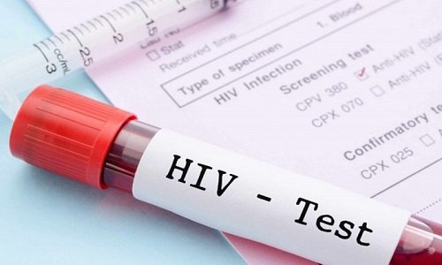 xét nghiệm hiv mất bao lâu