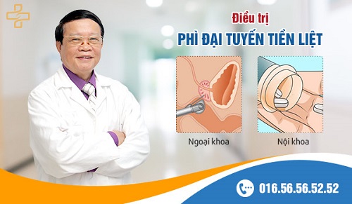 địa chỉ điều trị phì đại tiền liệt tuyến uy tín địa chỉ điều trị phì đại tiền liệt tuyến uy tín