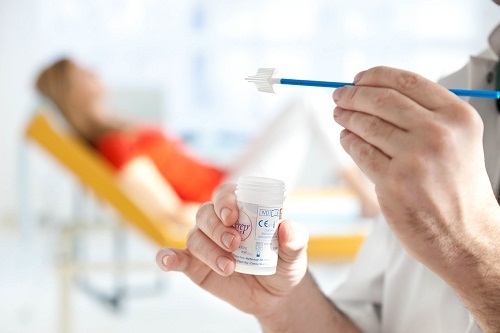 phương pháp xét nghiệm virus hpv ở miệng