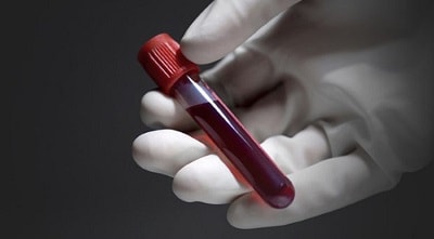 chỉ số xét nghiệm máu rbc