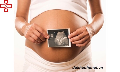 lịch siêu âm thai định kỳ cho bà bầu