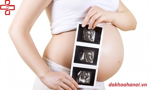 siêu âm nhiều có tốt cho thai nhi không