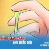 khi-hu-mau-xanh-nhu-nuoc-mui