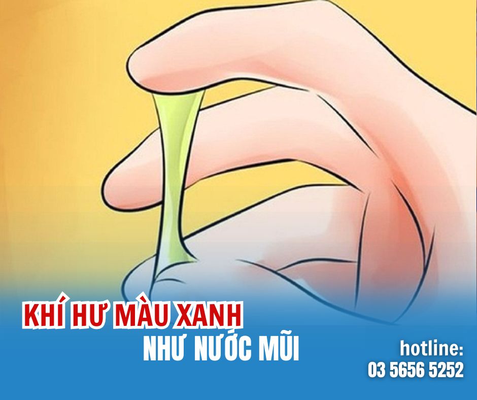 Khí hư màu xanh như nước mũi