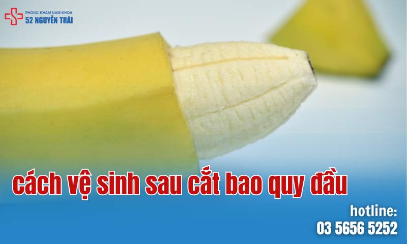 Cách vệ sinh vết thương sau phẫu thuật cắt bao quy đầu một cách an toàn và hiệu quả