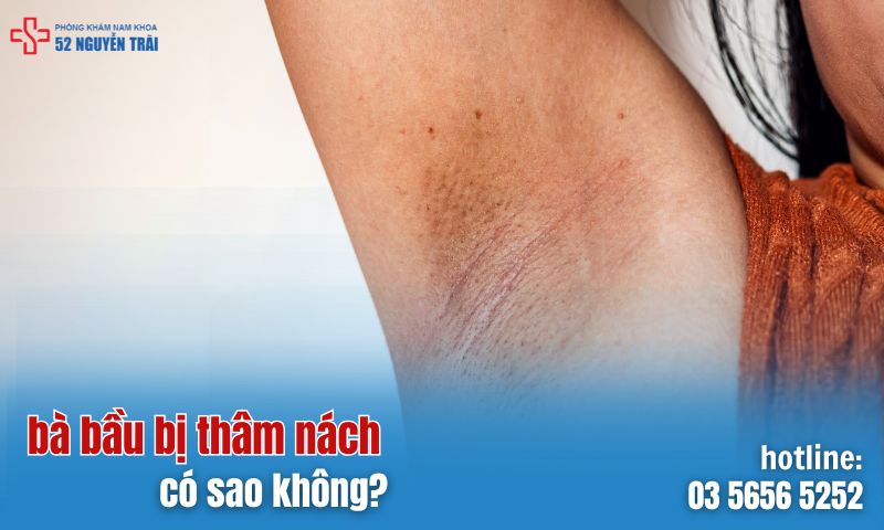 Bà bầu bị thâm nách có sao không?