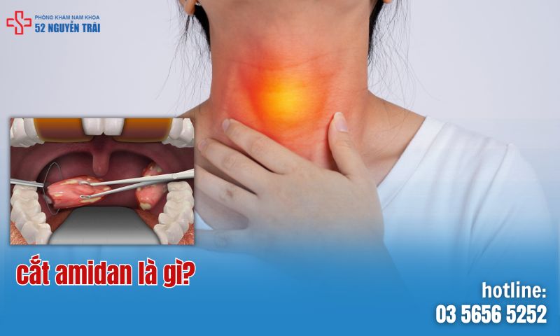 Cắt amidan là gì và khi nào cần thực hiện?