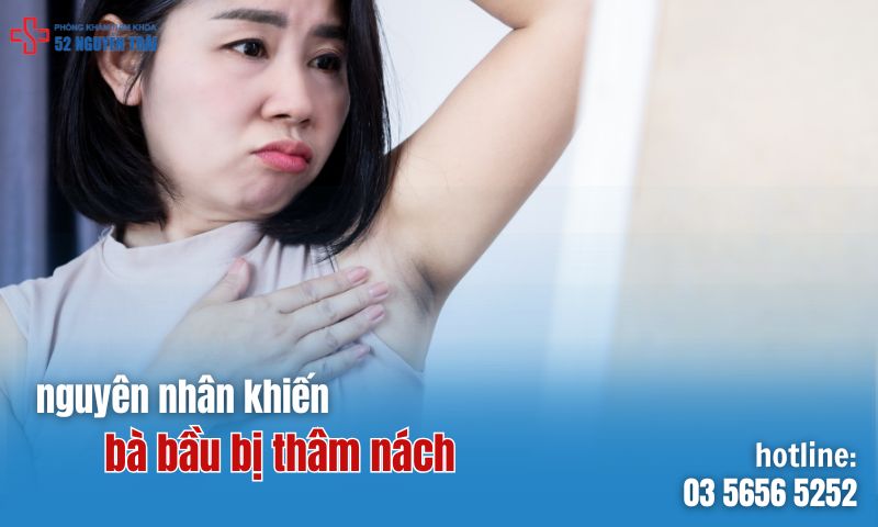 Nguyên nhân khiến bà bầu bị thâm nách đến từ đâu?