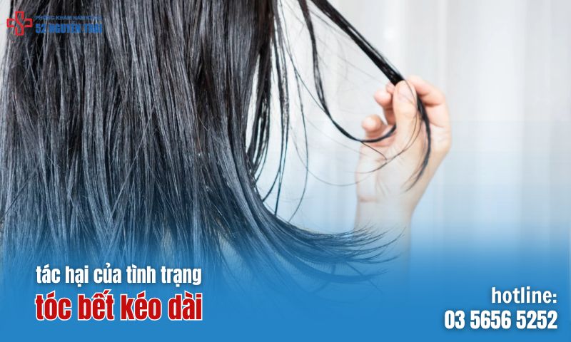 Tác hại của tình trạng tóc bết kéo dài