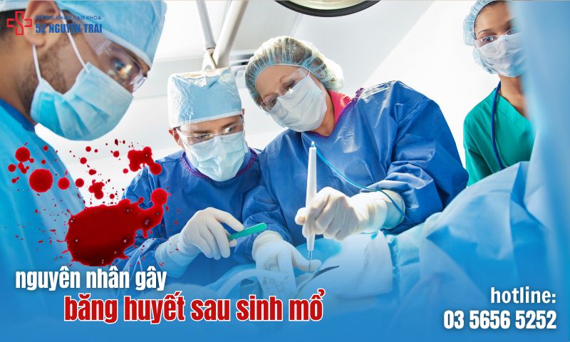 Nguyên nhân gây băng huyết sau sinh mổ