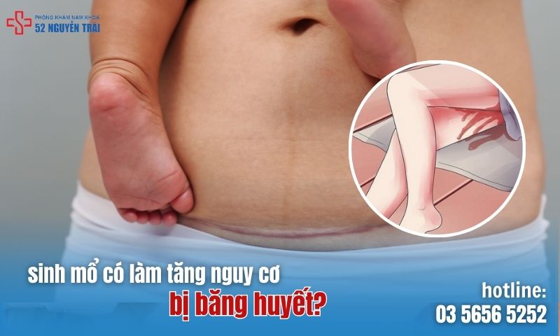 Sinh mổ có làm tăng nguy cơ bị băng huyết không?