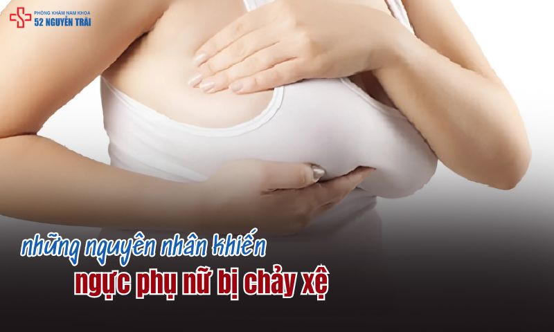 Nguyên nhân khiến ngực phụ nữ bị chảy xệ là gì?