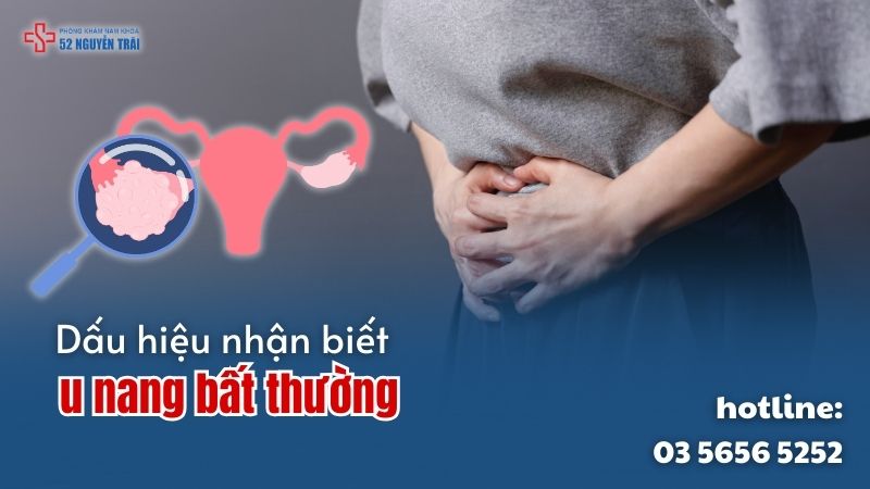 Dấu hiệu nhận biết u nang bất thường