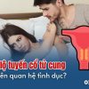 bi-viem-lo-tuyen-co-nen-quan-he-tinh-duc