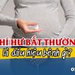 khi-hu-bat-thuong-la-dau-hieu-cua-benh-gi