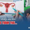 dat-vong-tranh-thai-xong-ra-khi-hu-nhieu