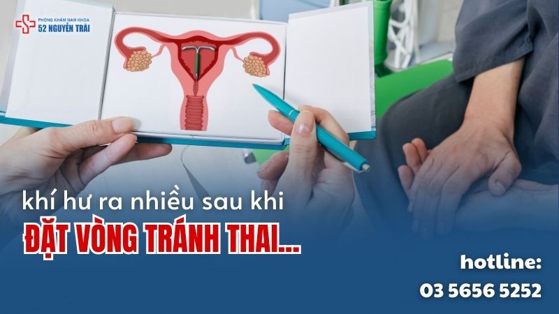 Đặt vòng tránh thai xong ra khí hư nhiều là lo lắng chung của nhiều chị em