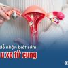lam-sao-de-nhan-biet-u-xo-tu-cung-tu-som