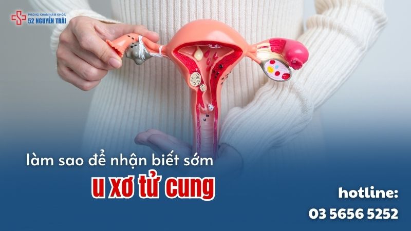 Làm sao để phát hiện u xơ tử cung từ sớm?