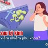 mui-hoi-sau-ky-kinh