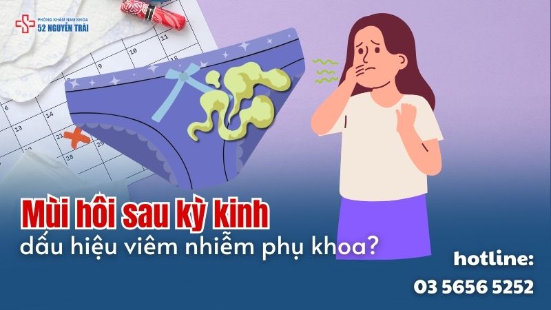 mùi hôi sau kỳ kinh có phải là dấu hiệu viêm nhiễm phụ khoa