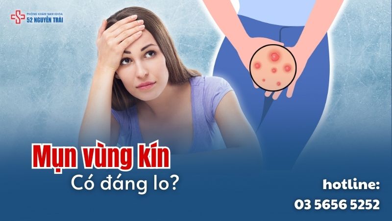 Mụn vùng kín có đáng lo không?
