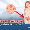 mun-vung-kin-truoc-ky-kinh