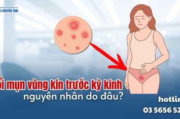 mun-vung-kin-truoc-ky-kinh
