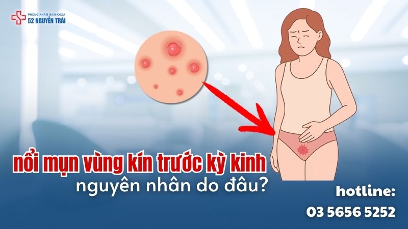 Vì sao nổi mụn vùng kín trước kỳ kinh?