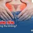 u-nang-buong-trung-co-phai-ung-thu-khong